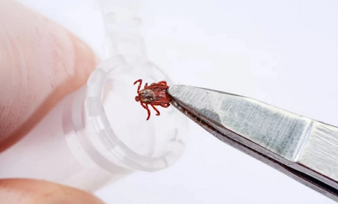 Из-за укуса клеща жительница Гродненской области оказалась в реанимации. Врачи рассказали, что с ней